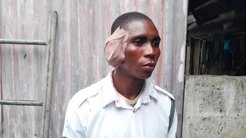 Drama As Driver Bites Off VIO Officer's Ear In Warri  