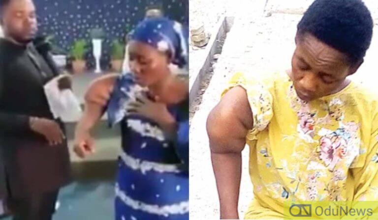 Audio Miracles: Woman With Deformed Arm Arrested By Police