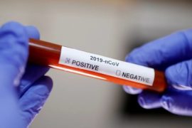 Nasarawa Confirms First Case Of Coronavirus  