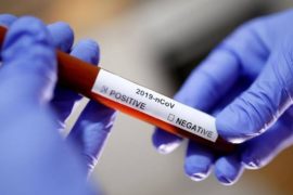 COVID-19: 25 Lebanese Evacuated From Kano Test Positive  