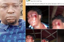 LASG Arrests Man Who Posted Bleeding Pictures Of Wife On Facebook After Beating Her  