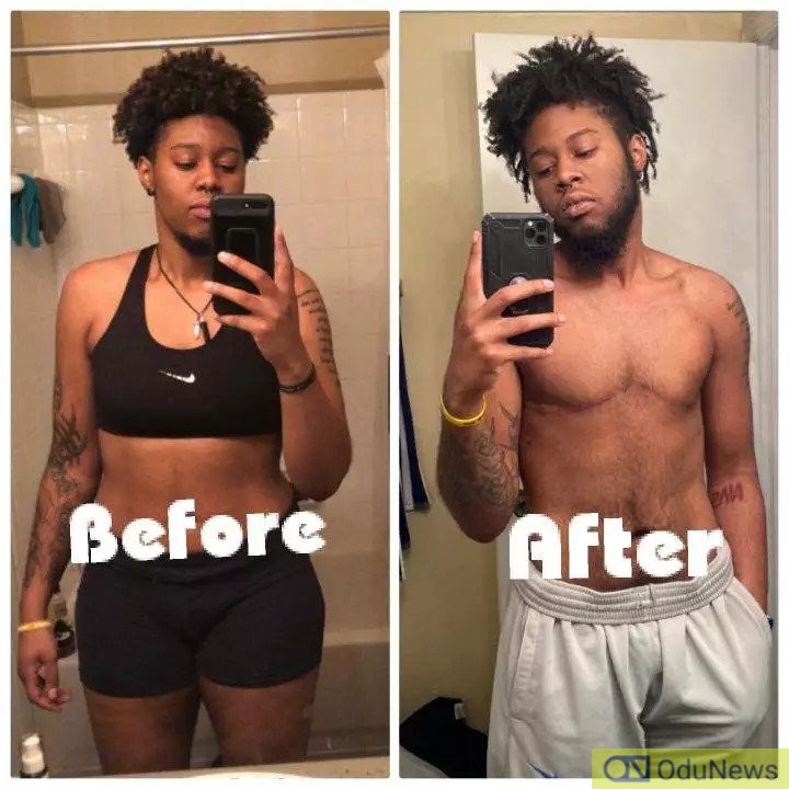 See Before And After Of The Girl That Changed To A Man Through Surgery