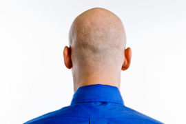 Calling A Man Bald Is Sexual Harassment - UK Court Rules  