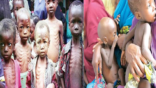 Over 500,000 children face severe malnutrition in three northwest states