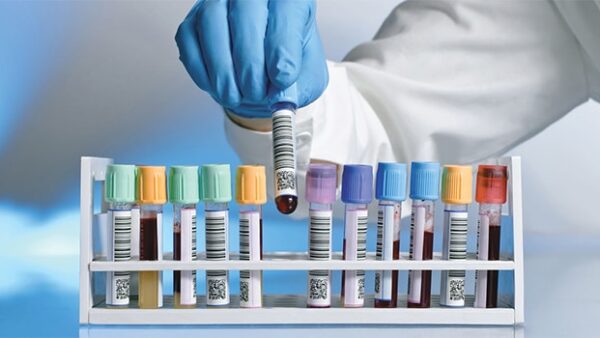 Oyo lab workers demand better pay, stricter water safety checks