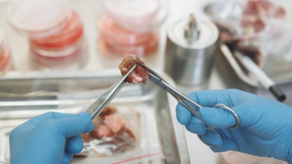 New drugs offer rare hope for pancreatic cancer patients