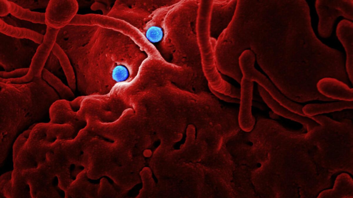 rodent carrying disease virus