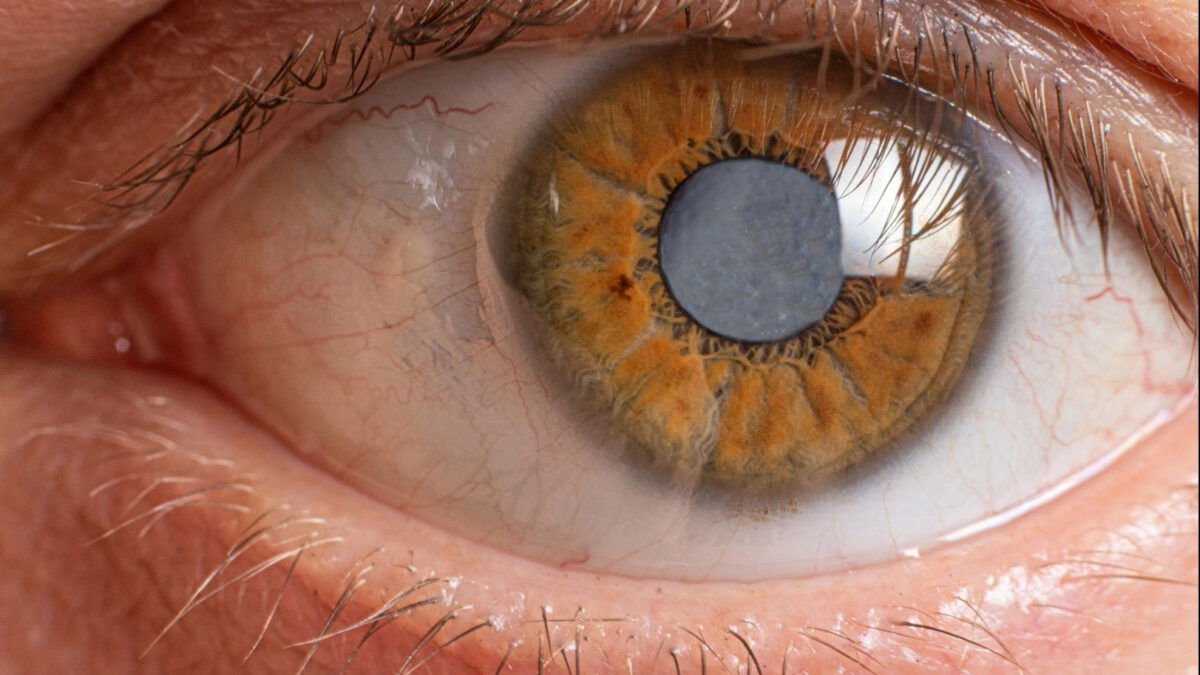 child eye examination vision test