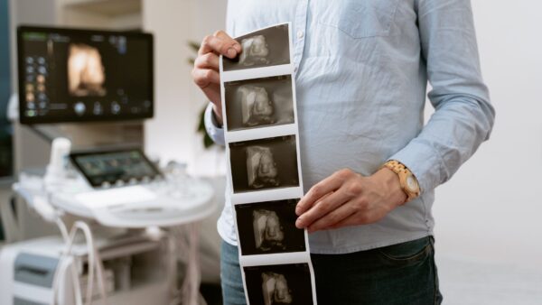 Drinking alcohol in pregnancy damages baby’s brain development, study finds